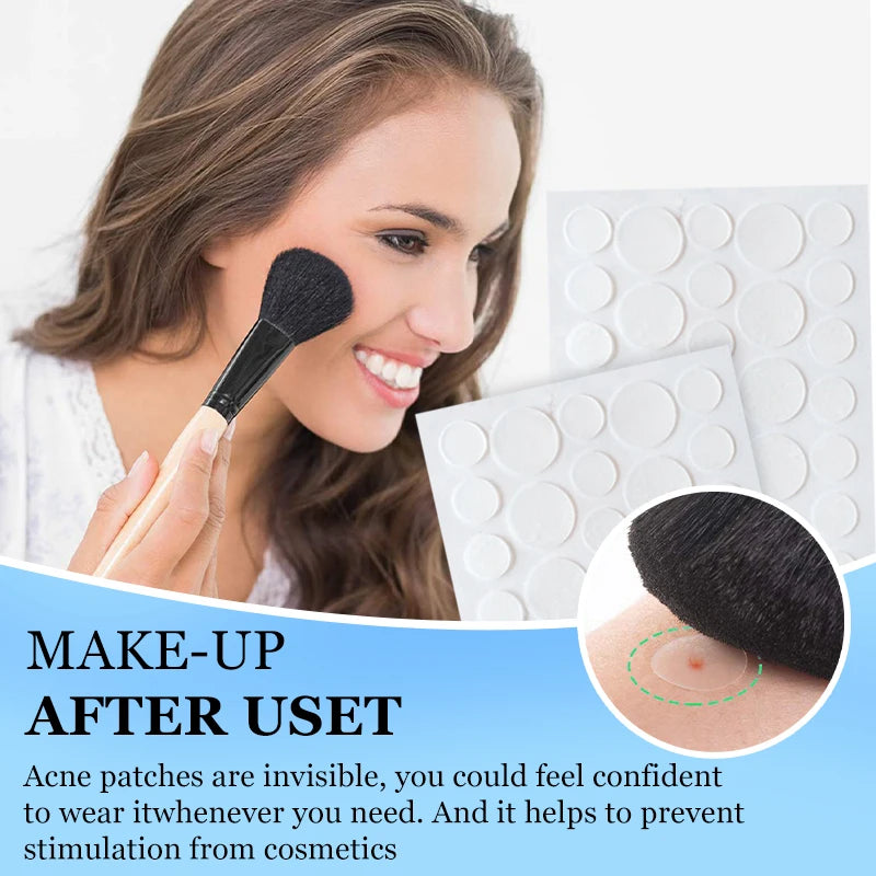 36 Count Acne Patches in 3 Colors for Face Hydrocolloid Patches with Acrylic by Wany Beauty