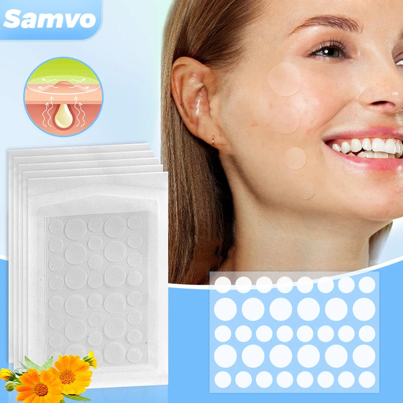 36 Count Acne Patches in 3 Colors for Face Hydrocolloid Patches with Acrylic by Wany Beauty