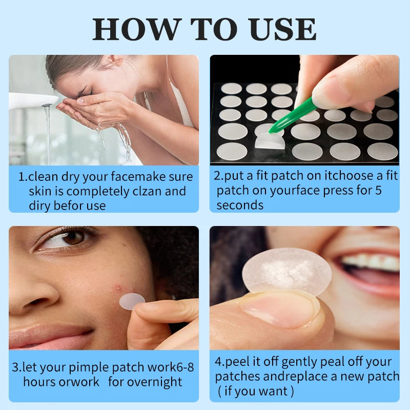 36 Count Acne Patches in 3 Colors for Face Hydrocolloid Patches with Acrylic by Wany Beauty