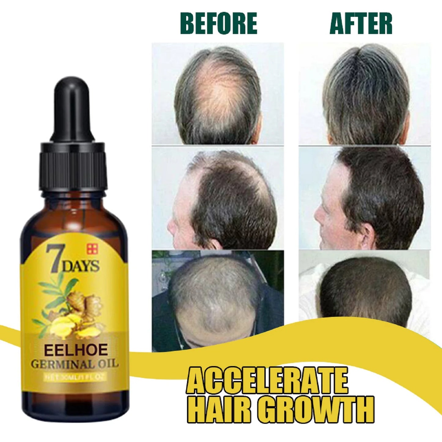 Ginger Hair Growth Oil — Strengthens, hydrates & boosts growth with 100% natural ginger oil. By Wany Beauty.